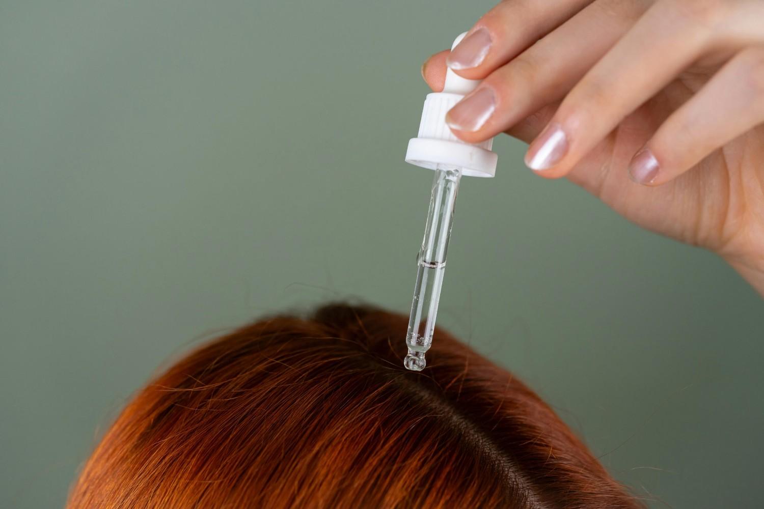 You are currently viewing Alps Goodness Anti Hairfall Scalp Serum: Review for you