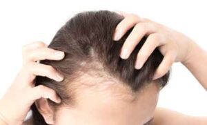 Read more about the article Best Hair Thickening & Volumizing Serums for Thin Hair – Expert Reviews & Buyer’s Guide (2025)